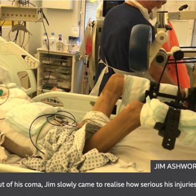 BBC News: Jim's recovery from the "verge of death"